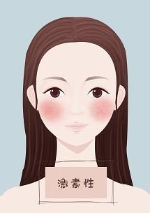 怎么消除臉上紅血絲（淡化紅血絲的簡單方法）(2)