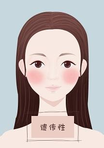 怎么消除臉上紅血絲（淡化紅血絲的簡單方法）(4)