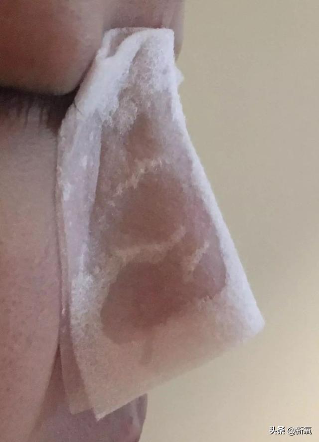 怎么去黑頭小竅門（手把手教你有效去黑頭的方法）(7)