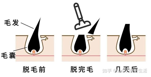 哪種脫毛膏安全又好用（5款爆火脫毛產(chǎn)品真人實測）(15)