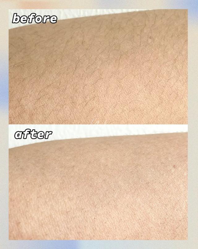 哪種脫毛膏安全又好用（5款爆火脫毛產(chǎn)品真人實測）(34)