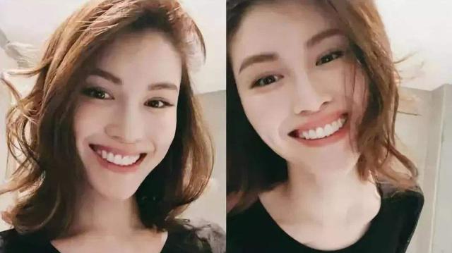 明星如何美白牙齒（各路明星牙齒美白秘籍大公開）(1)