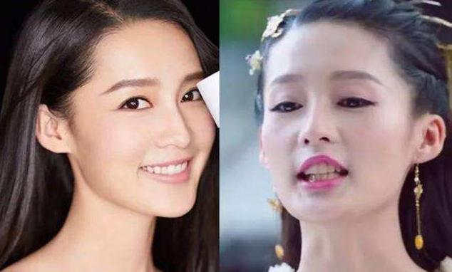 明星如何美白牙齒（各路明星牙齒美白秘籍大公開）(3)
